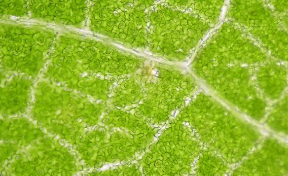 Chlorophyll under the microscope.